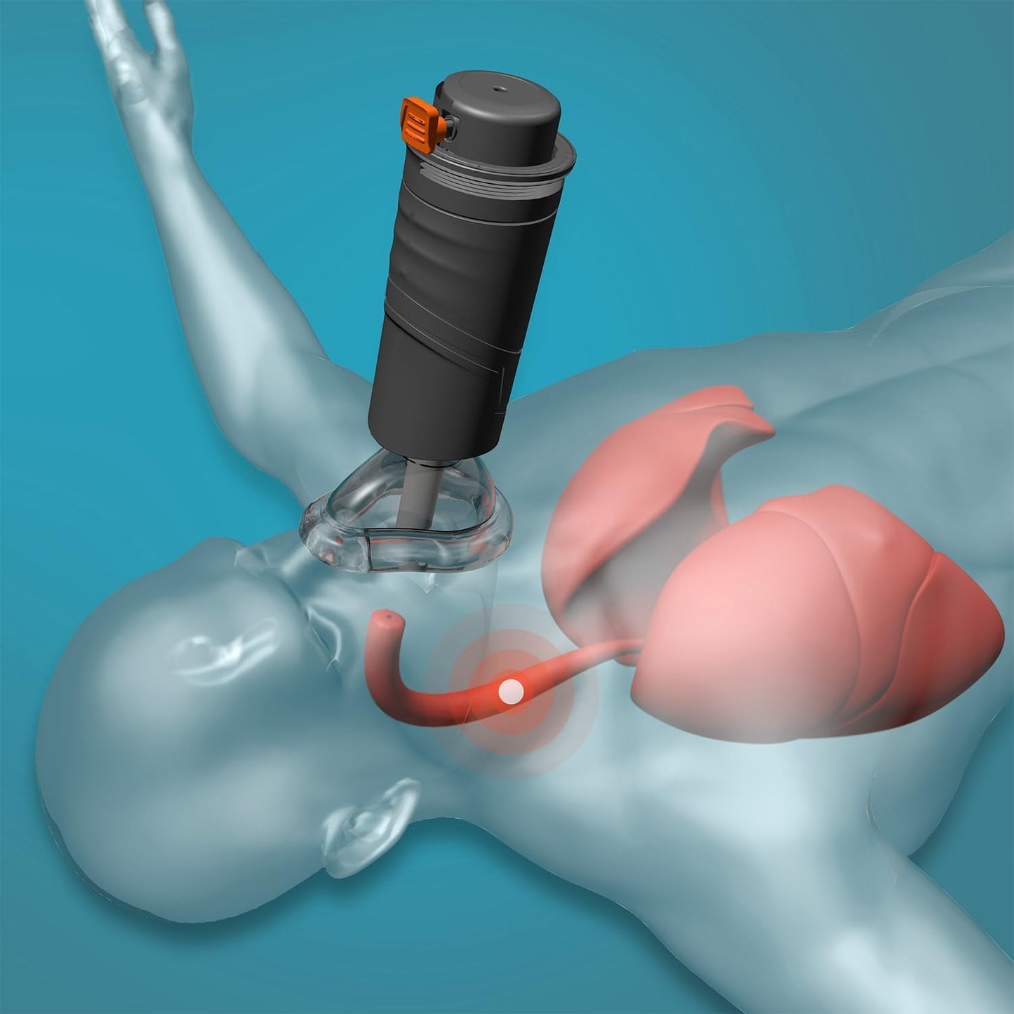 【家族を守るNO.1】Sonmol 窒息防止デバイス